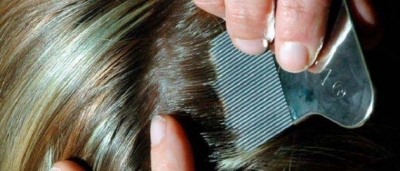 How to get ride of lice