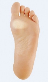 How to heal a blister